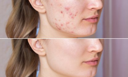 Dienstleistungen - Medgel