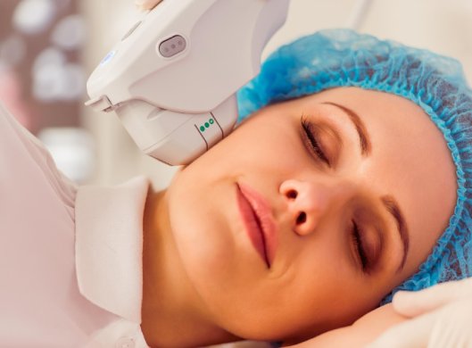 Ultherapie Service - Medgel